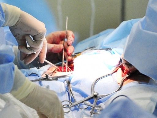 Перша в Україні пересадка штучного серця: як жити далі
