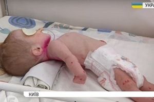 Волонтери звинуватили медиків у погіршенні стану немовляти
