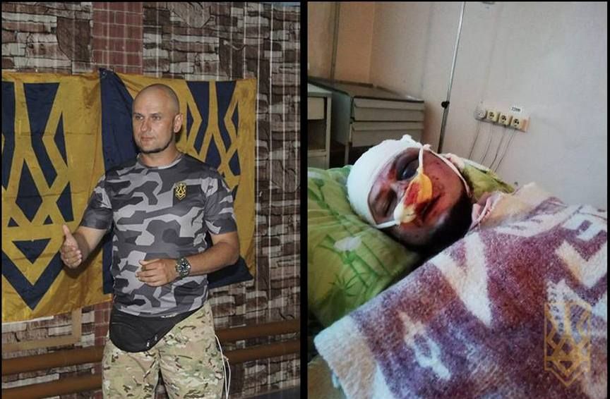 У Павлограді побили активіста «Націанальних дружин» Юрія Малімонова