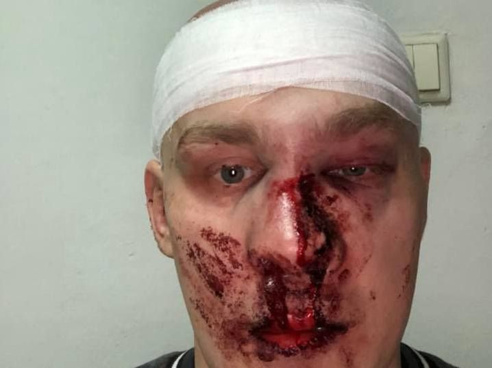 У Харкові екс-командир «Східного корпусу» Ширяєв побився із активістом «Національного корпусу»