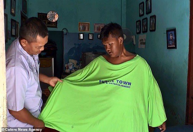 Найгладший хлопчик Індонезії схуд на 95 кілограмів (фото)