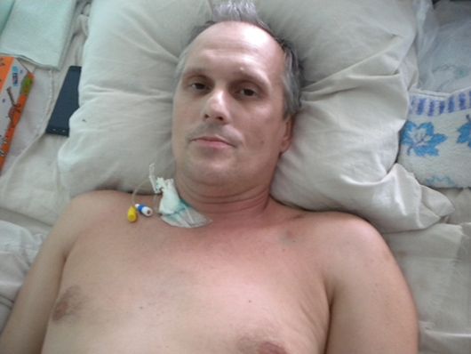 Житель Нікополя дивом вижив після того, як його наскрізь пронизав металевий профіль