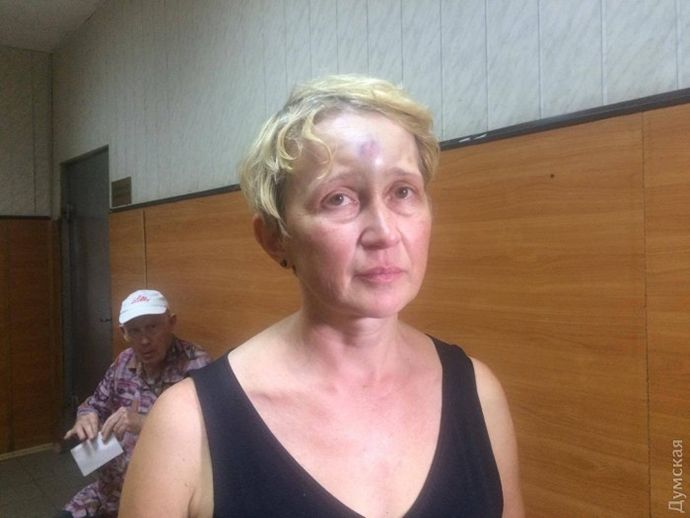 В Одесі жорстоко побили журналістку та екозахисницю Світлану Підпалу (відео)