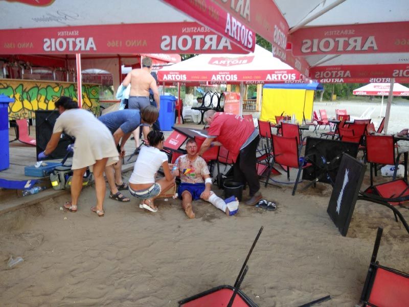 У Полтаві стріляли на пляжі: один загиблий, двоє поранених (фото, відео)