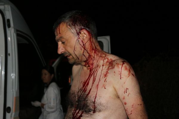 На Одещині побили головреда «Наддністрянської правди» Романа Варшанідзе