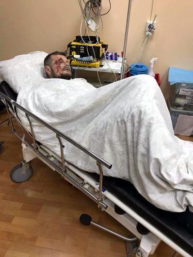Ляшко про замах на Мосійчука: «Нашу команду не залякати»