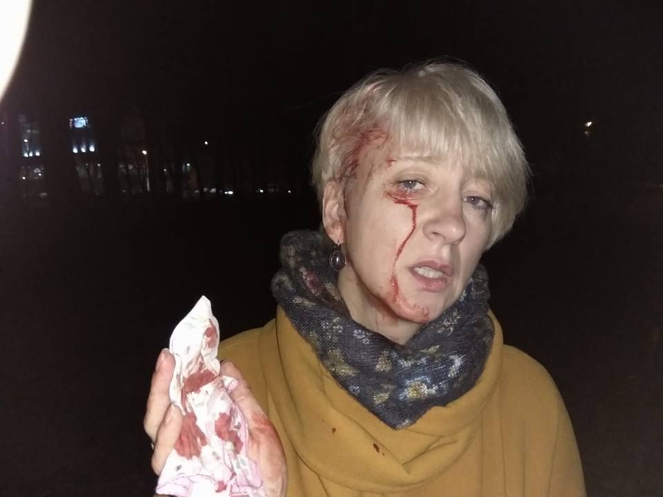 У Полтаві побили трубами суддю Ларису Гольник з чоловіком (фото)