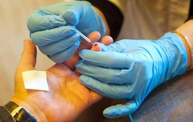 У Миколаєві спалах захворювання на жовтяницю: у лікарні майже 40 осіб