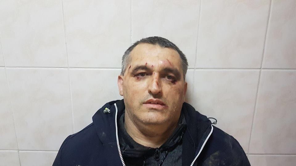У Чернівцях побили активіста «Стоп корупції» Валерія Аіріні