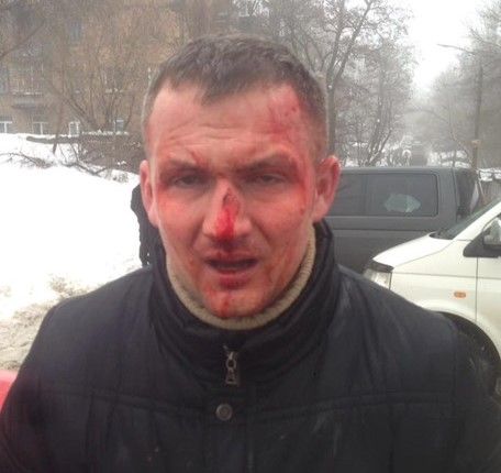 У Києві побили депутата Юрія Левченка