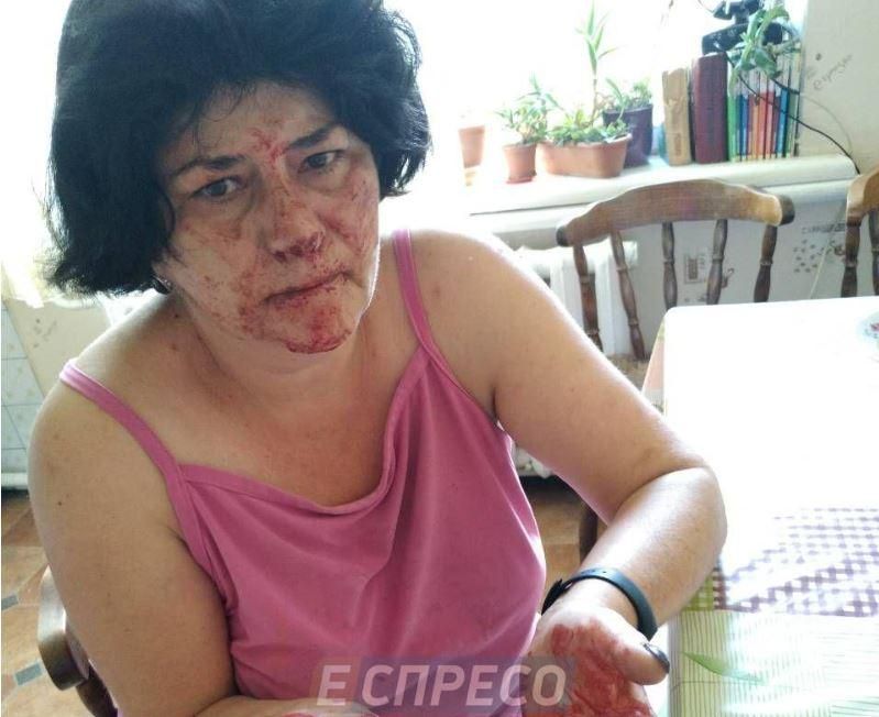 В селищі під Києвом тренер із тхеквондо та його брат жорстоко побили жінку за зауваження