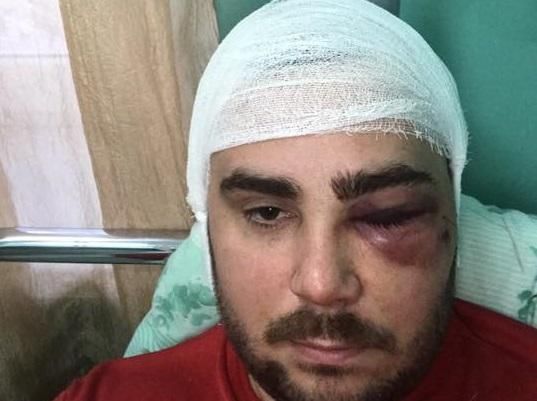 У Запоріжжі побили та поранили з пістолета лідера АвтоЄвроСили
