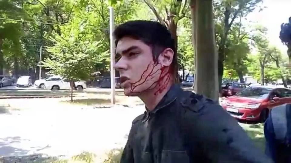 Одеський активіст Устименко заявляє, що із СІЗО випустили можливого організатора замаху на його життя