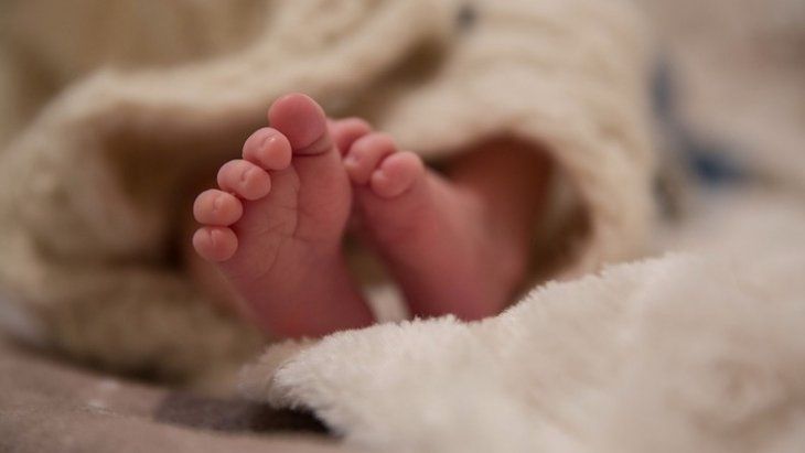 У Чернівцях народилися сіамські близнюки