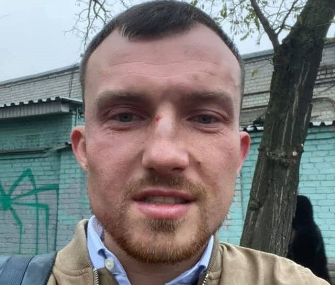Поліція встановила підозрюваних у нападі на Лємєнова