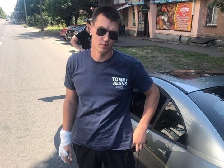 У Черкасах на дорозі двоє напали на водія авто і били його молотком по голові