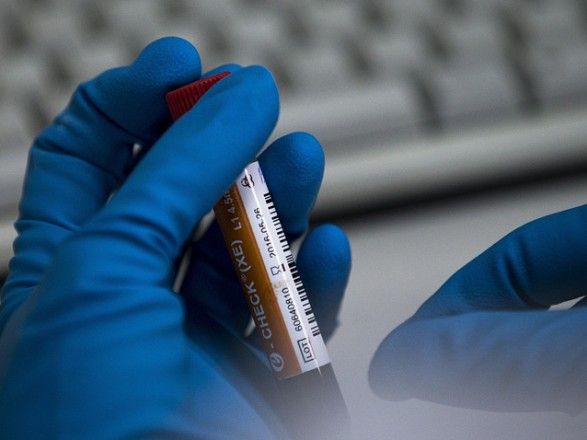 У схемі «україно-американської фарммафіі» замішана всесвітньовідома служба доставки Fedex