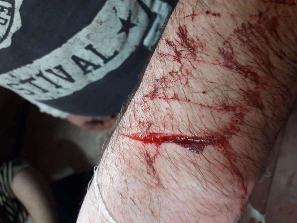 Бунт у СІЗО: у Чернівцях різали собі руки через арештанта із коронавірусом