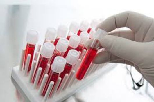 У Харкові, Сумах та Черкасах почали збір крові зцілених від коронавірусу для розробки ліків