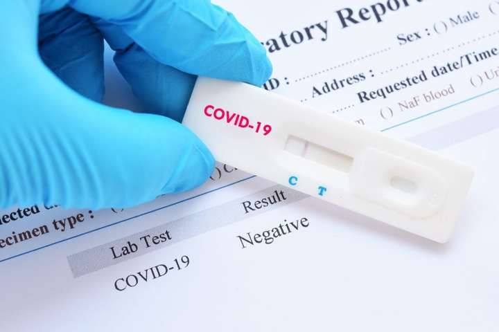Експрес-тестування на Covid-19 проводитимуть сімейні лікарі та мобільні бригади – Степанов