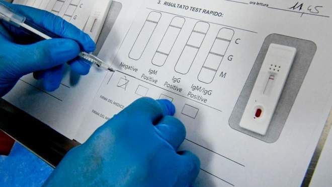 В Україні продають експрес-тест на коронавірус, який забракували у Франції