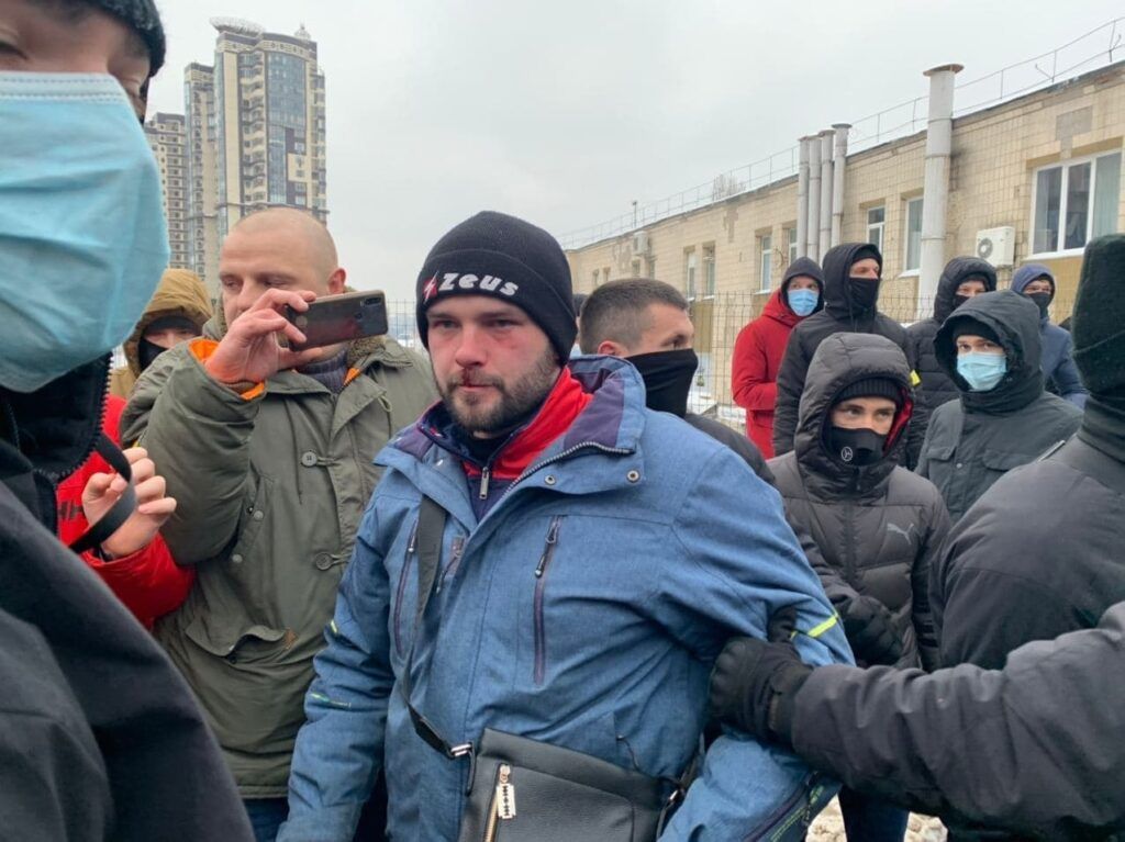 У Києві заблокували базу «тітушок» з руху «Патріоти за Життя»