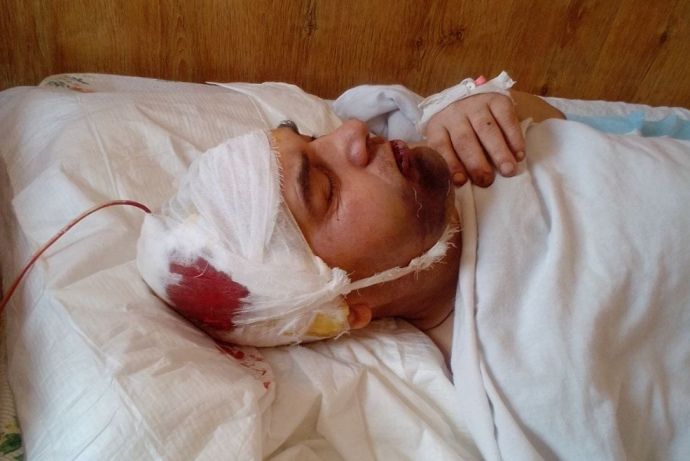 На Волині офіцер-тиловик  жорстоко побив ногами пораненого солдата-фронтовика