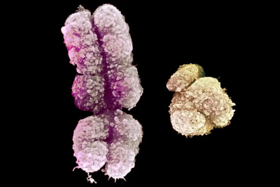 Х-хромосому людини (ліворуч) і Y-хромосому видно за допомогою скануючого електронного мікроскопа