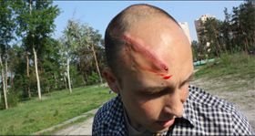 Побилися через церкву