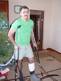 Депутат районної ради Олександр Жура три тижні провів у лікарні й досі пересувається за допомогою милиць.